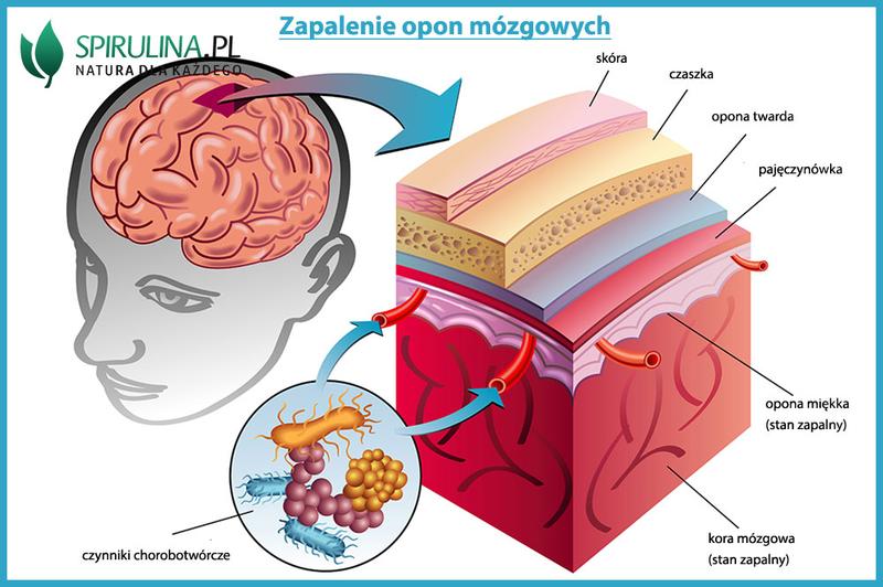 Jakie badania są kluczowe w diagnostyce zapalenia opon mózgowych?